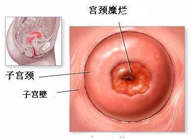 运城妇科医院